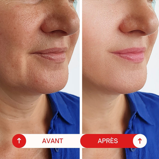 Collagen Lip Repair Treatment