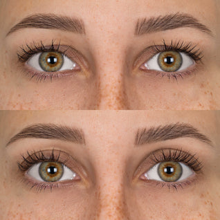 Eyelid Lifting Patches