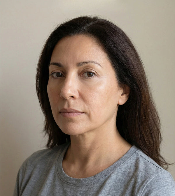 Après - Myriam 48 ans