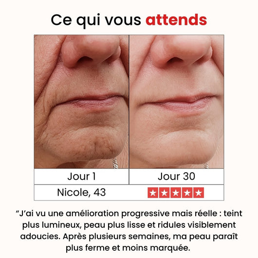 Vitamin C Anti-Wrinkle Serum
