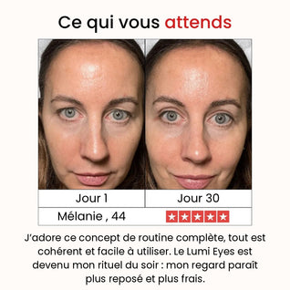 Coffret Régénération Intense